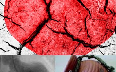 Može li se umreti od slomljenog srca? Ili Takotsubo kardiomiopatija